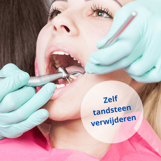 tandartsbehandeling tandsteen verwijderen